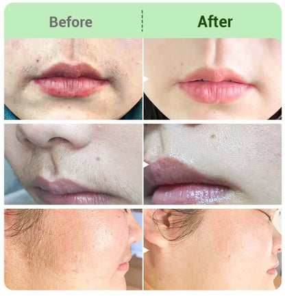 💛Hair Removal Cream Kit for Women