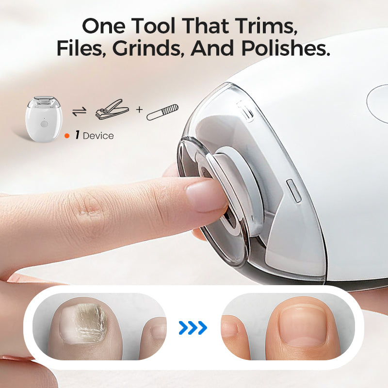💅✨ Universal Automatic Fingernail Grinder – Painless & Safe for Adults & Kids 👶🔧 50% OFF HOT SALE! Effortless trimming, smooth edges, no cuts. Perfect for family use. One tool for all ages.