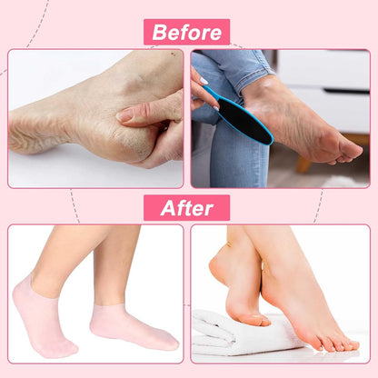 🔥Moisturizing Foot Mask Exfoliating Silicone Socks Beach Protective Socks(3pcs)