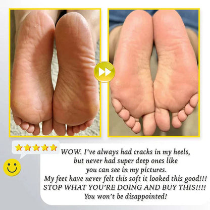 ⏳ Limited-time offer⏳ Rechargeable electric foot file for calluses Two speeds and removable grinding head USB charging Available in four colors