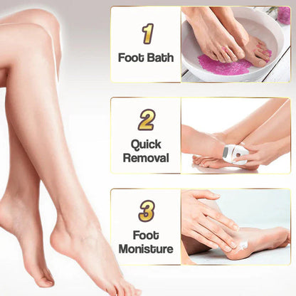 ⏳ Limited-time offer⏳ Rechargeable electric foot file for calluses Two speeds and removable grinding head USB charging Available in four colors