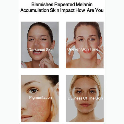 🎅Christmas promotion 49% OFF🎁Radiant Skin & Spot Correcting Spray|Buy 2 Get 1 Free 💗