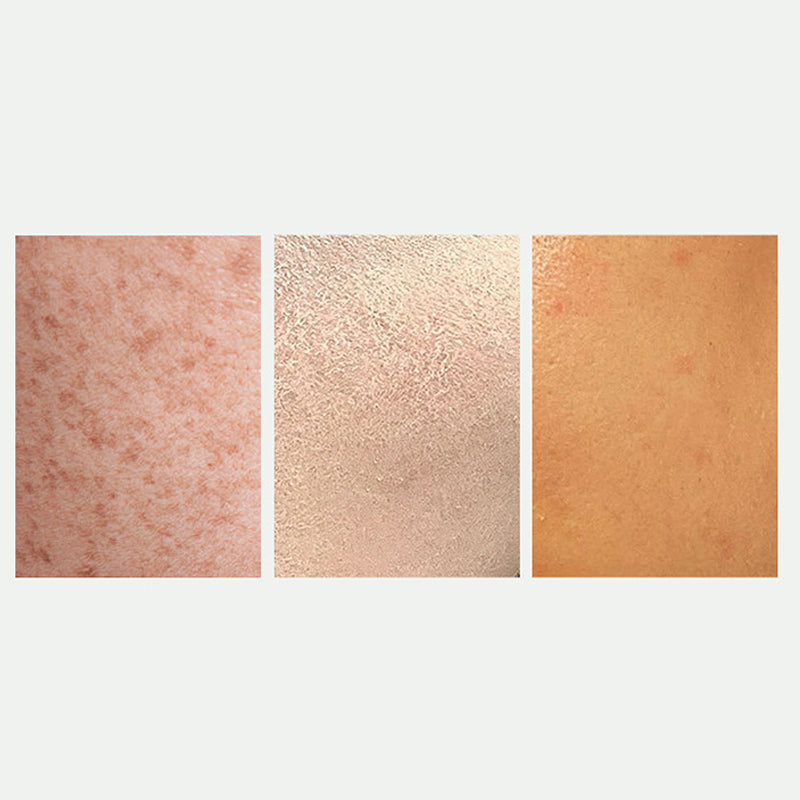 🎅Christmas promotion 49% OFF🎁Radiant Skin & Spot Correcting Spray|Buy 2 Get 1 Free 💗