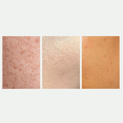 🎅Christmas promotion 49% OFF🎁Radiant Skin & Spot Correcting Spray|Buy 2 Get 1 Free 💗