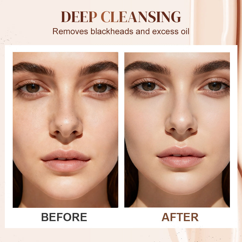 Today's Flash Sale🔥Buy 2 Get 1 Free💥Aloe Vera Blackhead Removal Beauty Gel