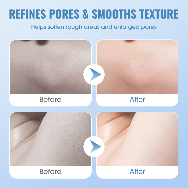 🔥🧖‍♀️ Gentle Deep Cleansing Exfoliating Gel 💕✨ Last Day 50% Off! Smooth skin, unclog pores, daily glow boost.