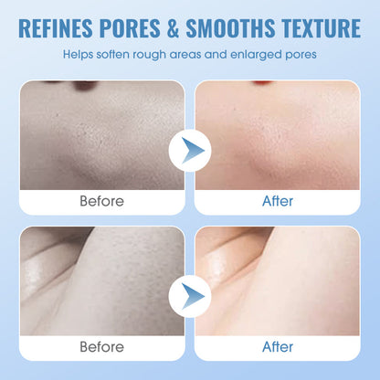 🔥🧖‍♀️ Gentle Deep Cleansing Exfoliating Gel 💕✨ Last Day 50% Off! Smooth skin, unclog pores, daily glow boost.