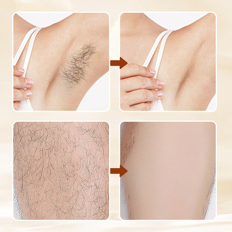 🧴55% OFF NOW! Mild Hair Removal Cream 100ml, Gentle Aromatic Depilatory Cream, Painless Body Hair Remover for Legs, Arms, Underarms & Bikini Area, Skin Softening Formula