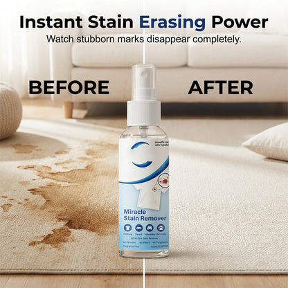🔥Limited Time Promotion 50% OFF🔥Miracle Stain Remover Spray