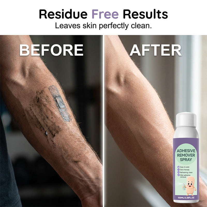 Mild Medical Tape Adhesive Remover Spray