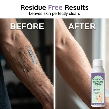 Mild Medical Tape Adhesive Remover Spray